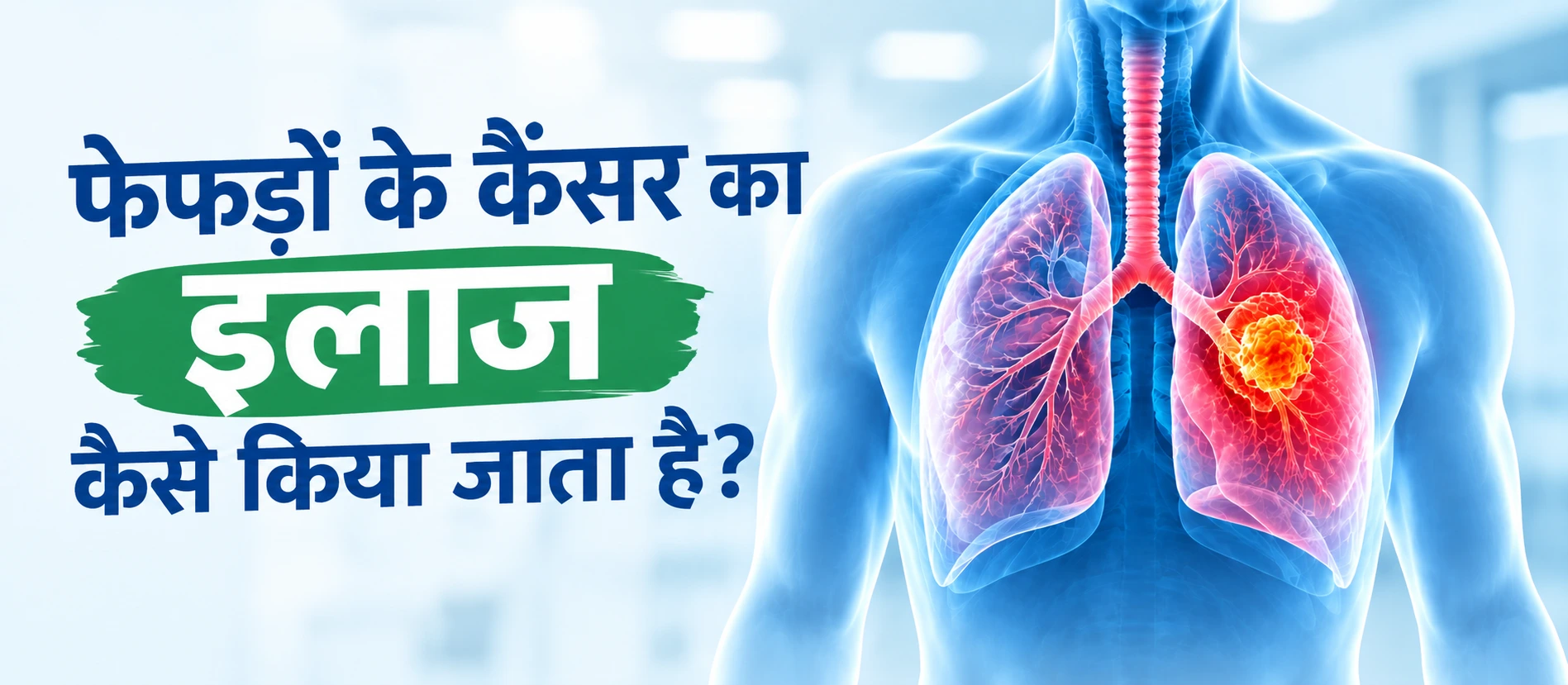 lung-cancer-treatment